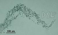 Image of Nostoc caeruleum