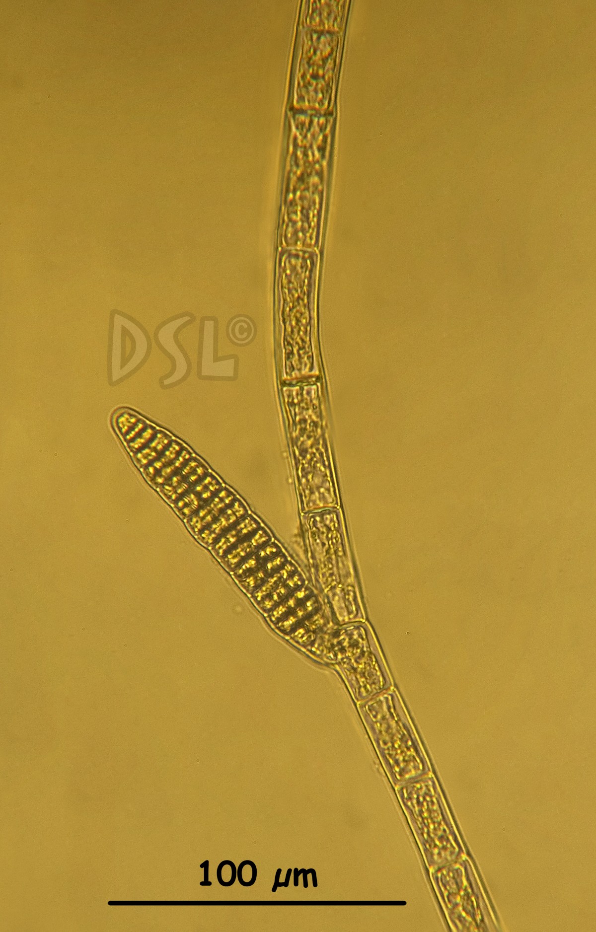Kuetzingiella elachistaeformis image